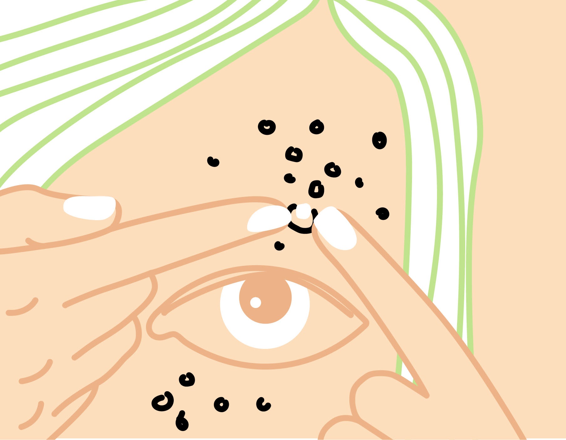 Sindrom policističnih jajčnikov